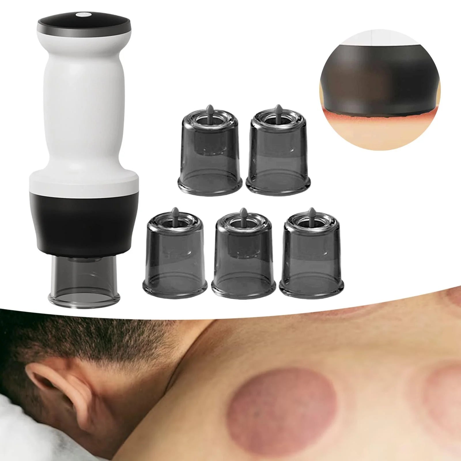 TheraCup™ Smart Massage System
